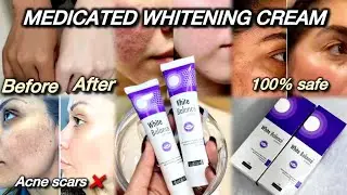 White Balance Cream Proper Use for Clear & Bright Skin ✨how to use this medicated cream properly🌼