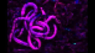 CAMMie Analysis 2: Vinyl Worm (Montgomery)