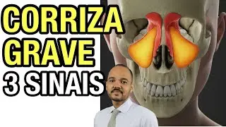 CORIZA: PODE SER UMA DOEN&Ccedil;A GRAVE! ENTENDA OS SINAIS E SINTOMAS DE GRAVIDADE