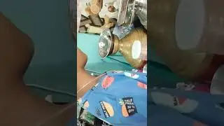 cutlet recipe @veg food@home made