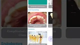 Learning Dental Trauma Made Easy