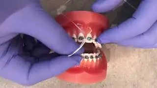 Modern Orthodontics Brushing Instructions