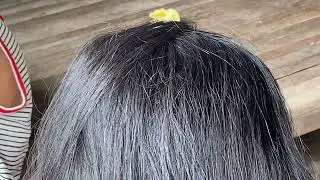 Lice removal by Chana for kids in countryside