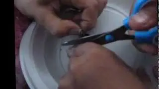 تشريح العين سنة 6