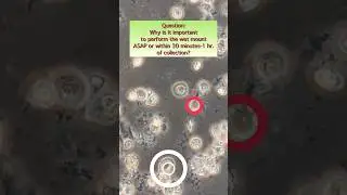 Why is it important to perform the wet mount ASAP? #shorts #medtech  #education #medtechstudent #fyp