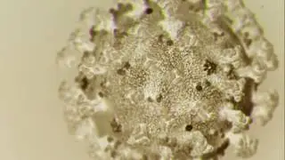 Ham Radio Fun: Panic and Anxieties Build as Coronavirus Takes Over Earth (2020)