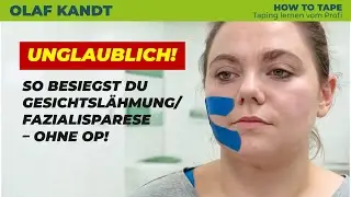Fazialisparese / Gesichtslähmung weg in 2 Wochen? Logopädinnen zeigen Tape-Erfolge | Olaf Kandt