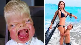Топ-15 удивительных и уникальных людей, в существование которых вы не поверите.
