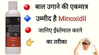 minoxidil and finasteride topical solution | morr f 5 uses in hindi | minoxidil side effects