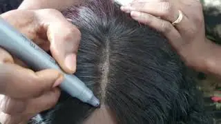 How to fix bald closure part on Weaves/Wigs!!!