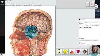 Automate bioresonance device (meta hunter 4025)