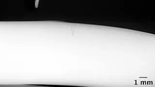 In-situ observation of weld solidification cracking from micro-radioscopy