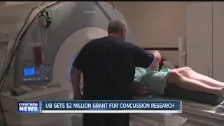 UB using major grant for teen concussion research