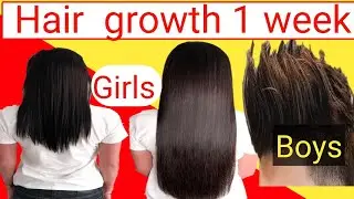 Law of Attraction hairline | Think and grow hair