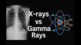 X-rays vs Gamma Rays: What's the Difference?
