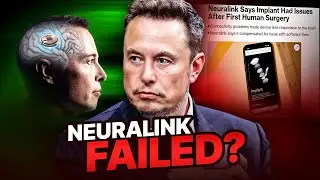 Elon Musk’s Neuralink is NOT worth it, or is it? - Neuralink fail #ai #neuralink #elonmusk