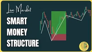 Perfect Entry Buy on Bottom with MMS Setup 