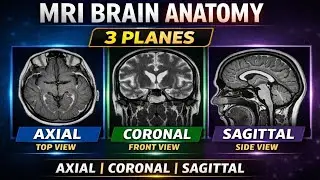 MRI Brain Anatomy in 3 Planes 🧠Axial |Coronal |SagittalRadiology students ke liye must-know basics 📚