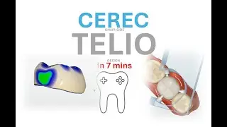 CEREC telio Design tutorial in 7 mins