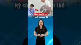 L&ocirc;i Run Rồng 30cm Ra Khỏi Cơ Thể | Thuốc Hay Thầy Tốt #thuochaythaytot #shorts