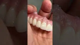 Great All-On-4 Zirconia
