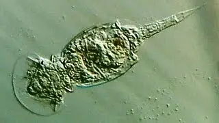 verschiedene R&auml;dertierchen -  (different Rotifer, Rotifera oder Rotatoria)