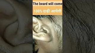 The beard will come 👌 100% दाढ़ी आयेगी #wantbeard #shorts