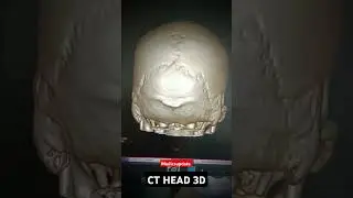 CT HEAD 3D VIEW || RADIOLOGY || CT SCAN  #radiologytech #doctor #ctscan #head #viralvideo #cartoon