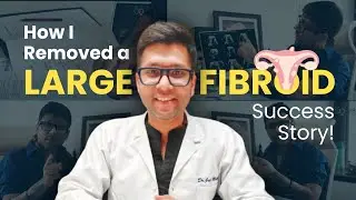 Fibroid की Surgery Delay करने के नुकसान: Risks & Solutions! | Case Study | Dr Jay Mehta, Mumbai