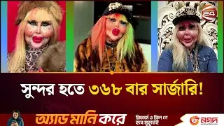 সুন্দর হতে ৩৬৮ বার সার্জারি, বিকৃত চেহারায় ভাইরাল ইরানি ইনফ্লুয়েন্সার | Iranian Influencer