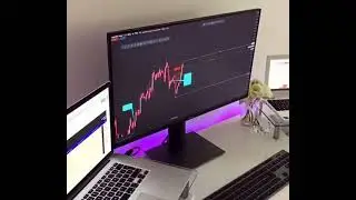 🔥 Free FOREX Signal Setup UK 💰💲 #crypto #forex  #forextrading  #trading  #forexsignals