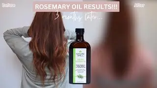 3 Months Of Using VIRAL TIKTOK Rosemary Hair Oil...It Didn't Go Quite To Plan!