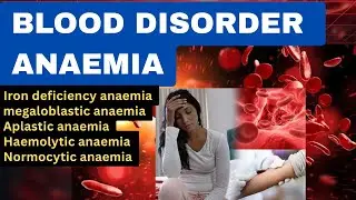 The 5 Types of Anemia Explained #anemia