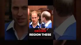 Why Derek takes hair loss so seriously #shorts #hairloss #moreplatesmoredates