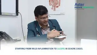 Acid Reflux: What It Really Means and Why It Happens