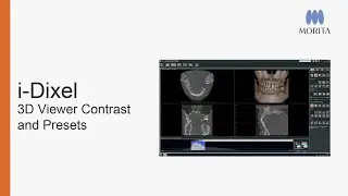 i-Dixel 3D Viewer - Contrast And Presets