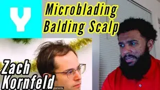 Try Guys Microblading Scalp For Balding | Reaction