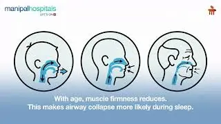 Snoring in Adults & Children | Dr. Debayan Tarafdar | Manipal Hospital Saltlake and Broadway