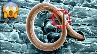 This Ancient Worm Was Frozen for 46,000 Years&hellip; and Came Back to Life