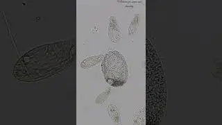Final Boss Microscopic Journey 3