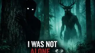 I Wasn&rsquo;t Alone in the Forest (No Dialogue Horror)💀☠️