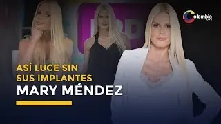 El impresionante cambio de Mary Méndez sin los implantes