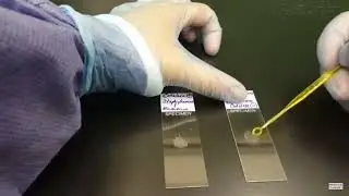 Professor Lester's Microbiology Lab - Respiration Nitrate Reduction & Catalase