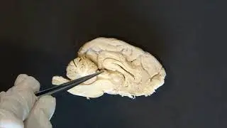 ANATOMIA VETERINÁRIA - CÉREBRO