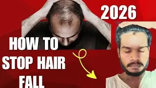 How To Stop Hair Fall ( अपने बालों को गिरने से कैसे बचाएं ) 