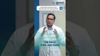 Treating Skin Lymphoma with Total Skin Electron Therapy (TSET)
