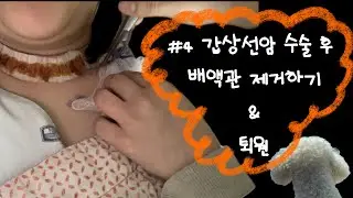 청년 갑상선암 전절제ㅣ갑상선암 수술 후 배액관 제거하기ㅣ퇴원날까지 병원 일상들ㅣ임파선 전이