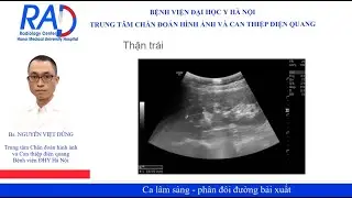 Không có triệu chứng, người khỏe mạnh gặp bệnh lý phân đôi đường bài xuất chiếm tới 0,7%