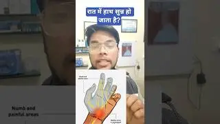 हथेली में सुन्नपन?जाने कारण,इलाज|Wrist Pain & Tingling? Ye ho sakta hai CTS #carpaltunnelsyndrome