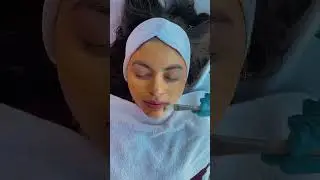 criolip&oacute;lisis #foryou #criolipolisis #limpiezadecutis #bbglow #parati #dermapen #microbland